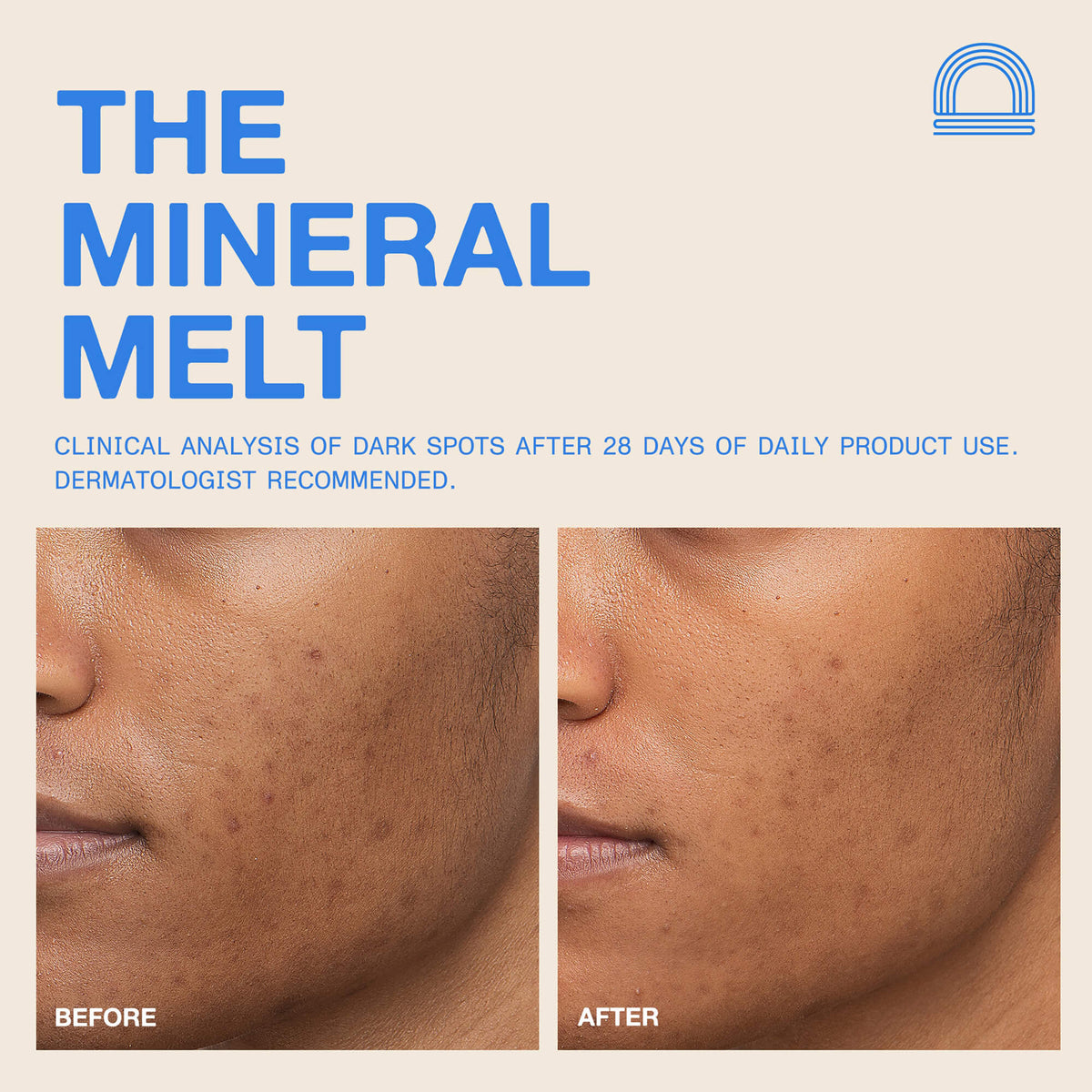 The Mineral Melt