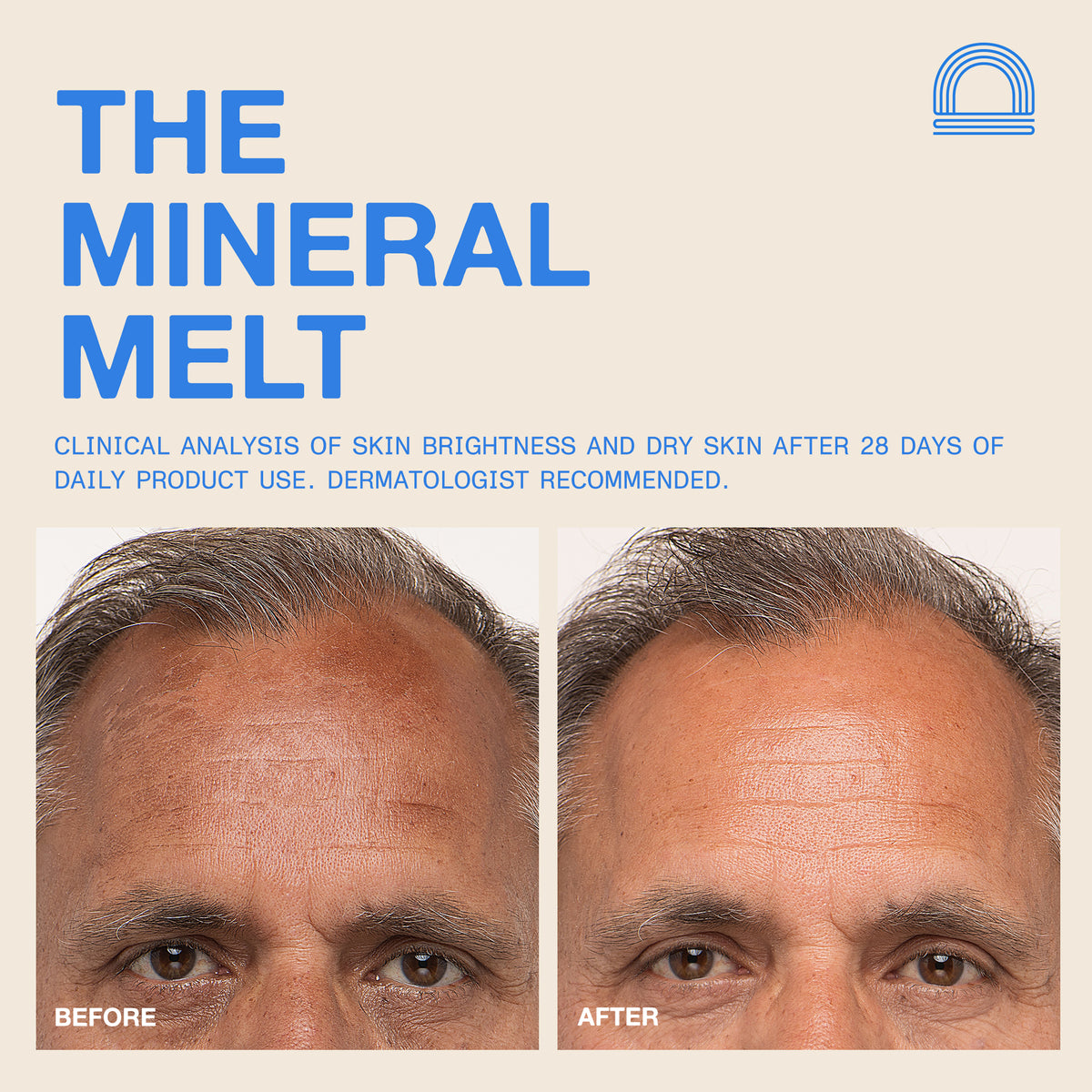 The Mineral Melt