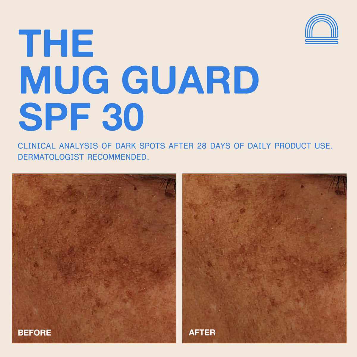 The Mug Guard