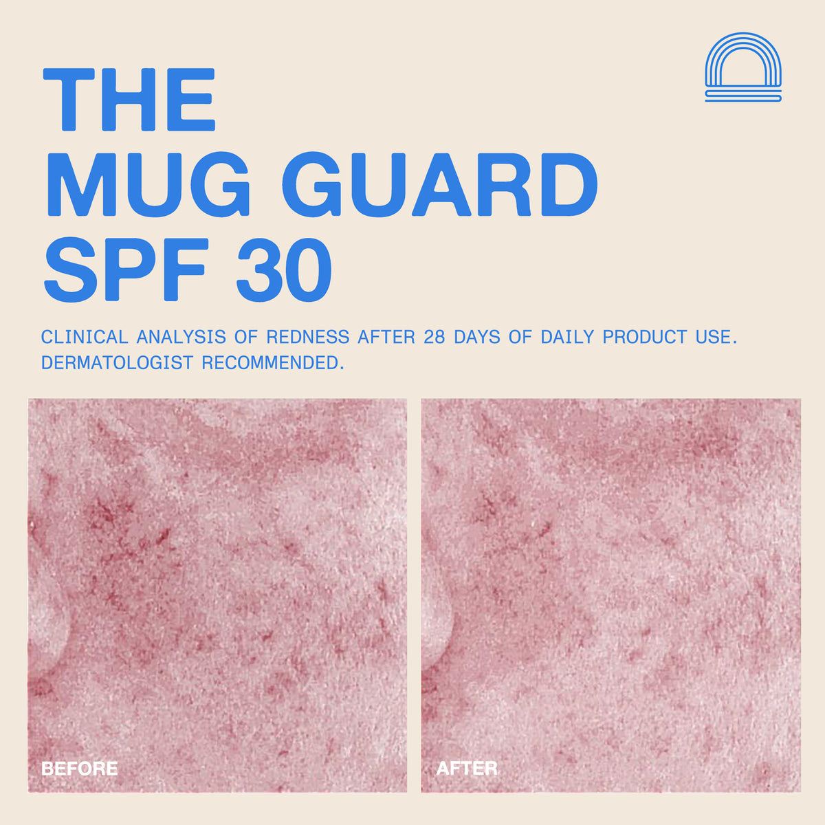 The Mug Guard