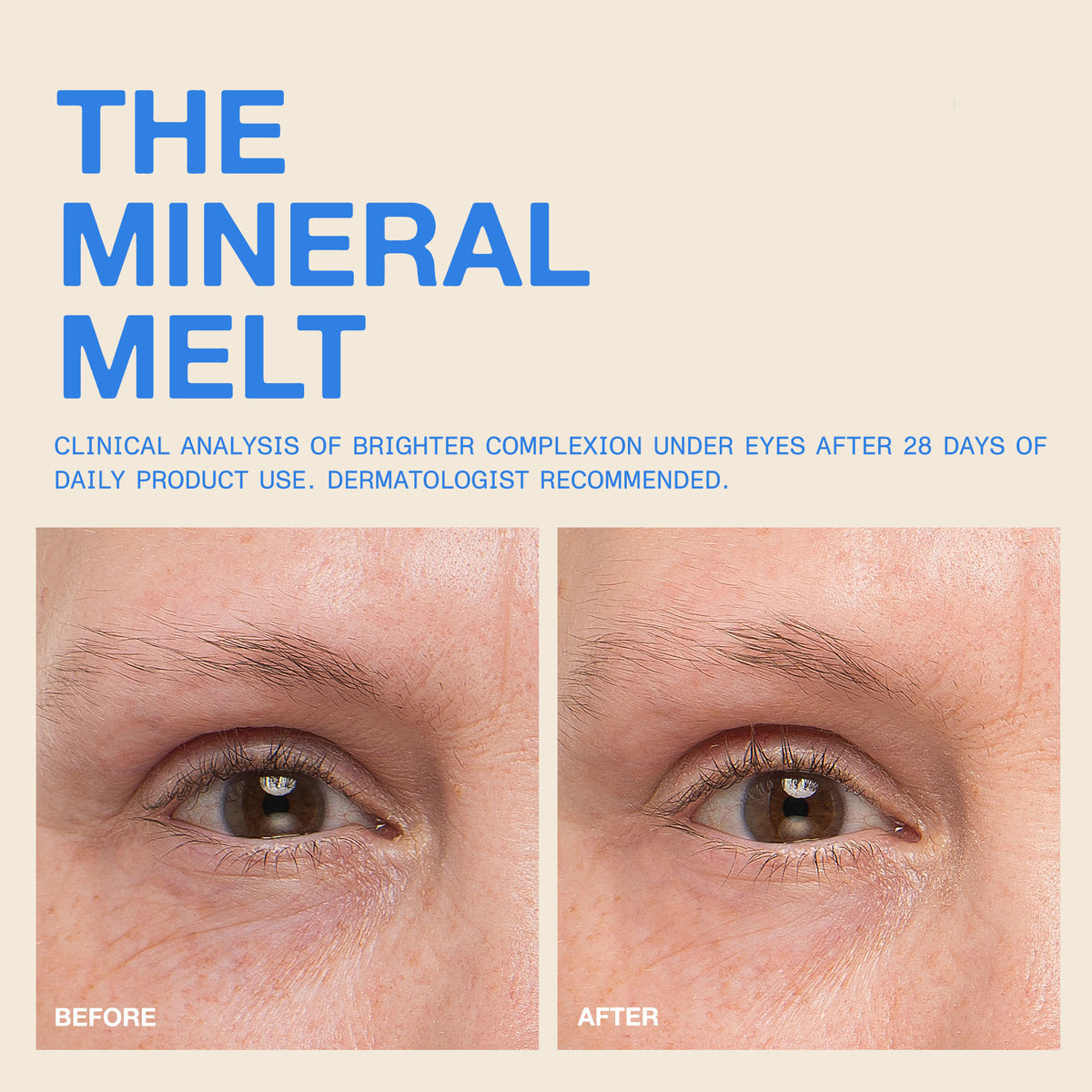 The Mineral Melt
