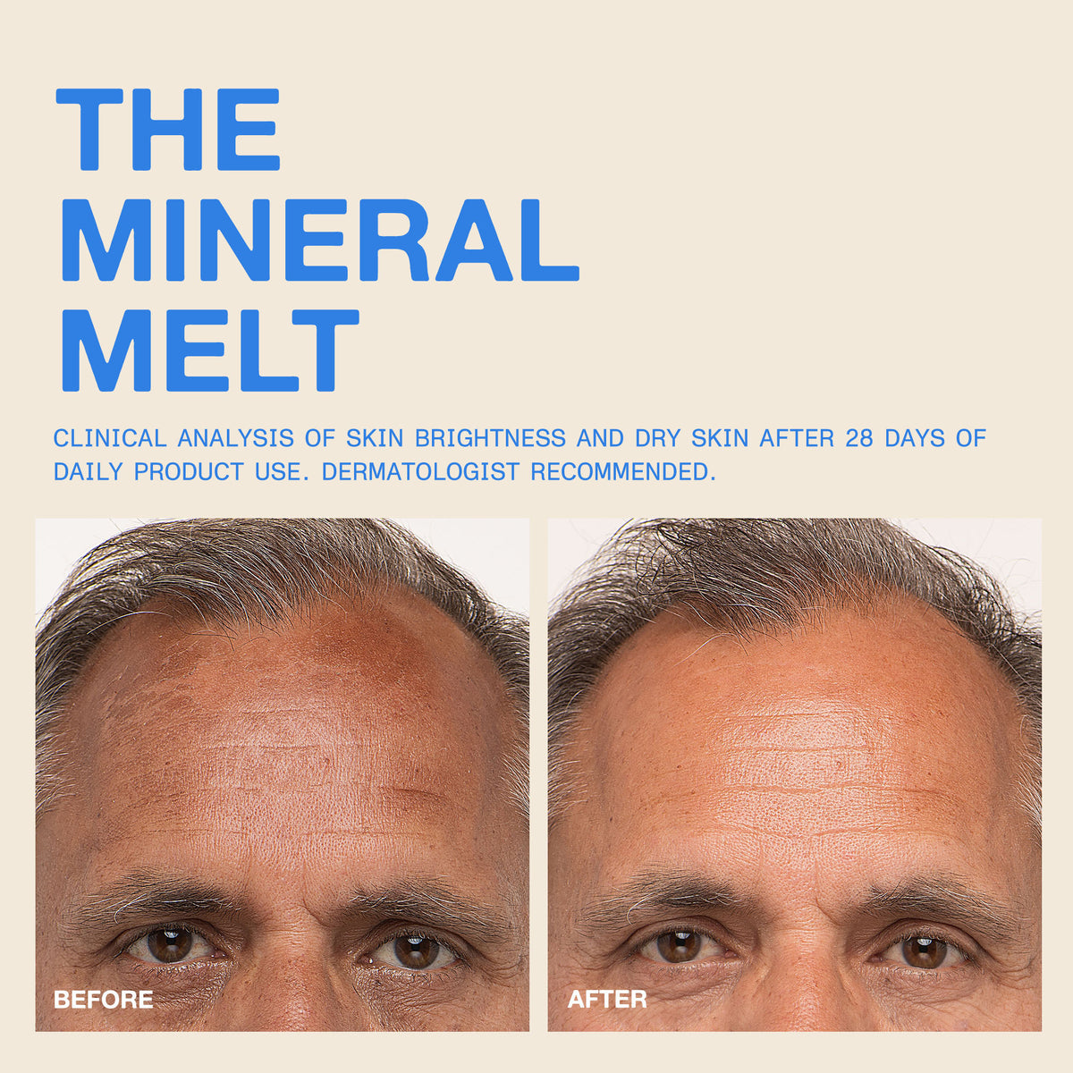 The Mineral Melt