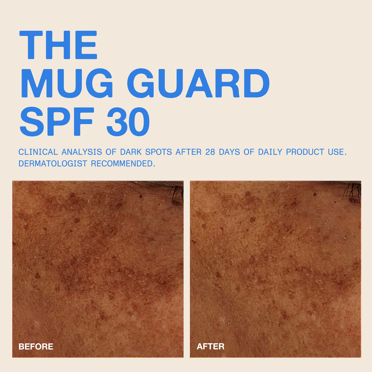The Mug Guard