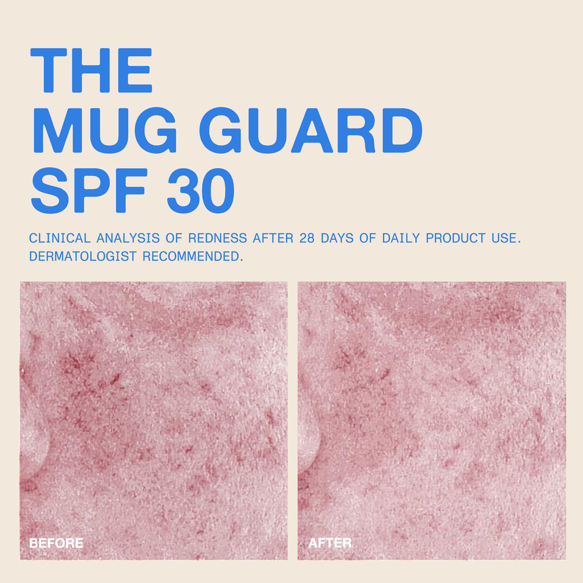 The Mug Guard